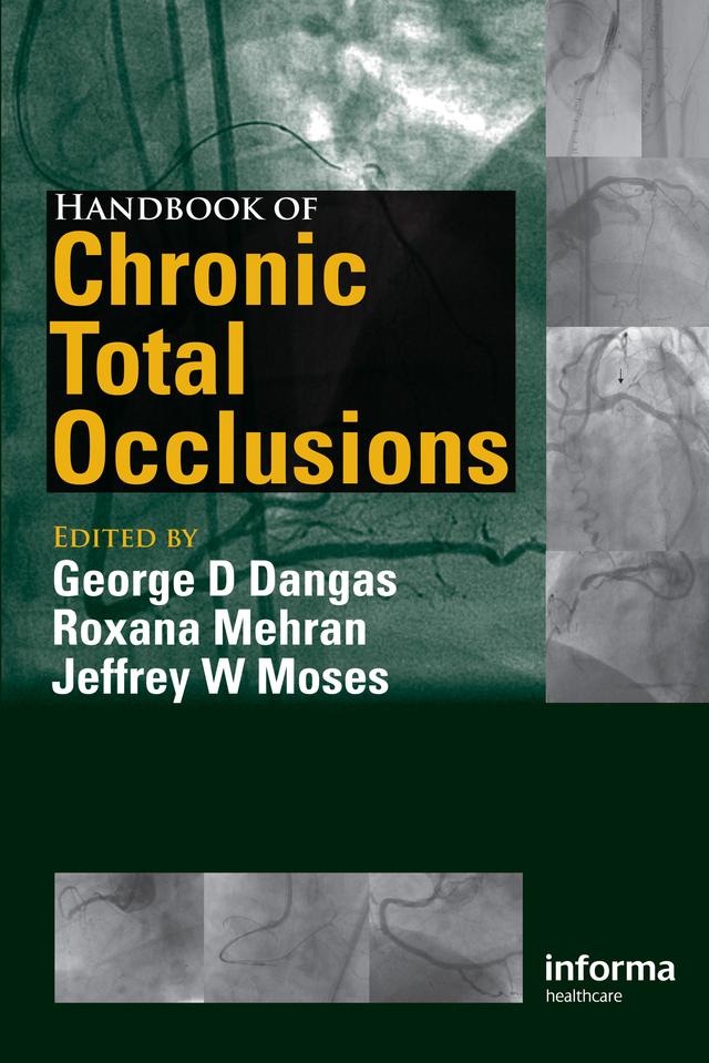 Handbook of Chronic Total Occlusions by George D. Dangas, Jeff Moses, Roxana Mehran