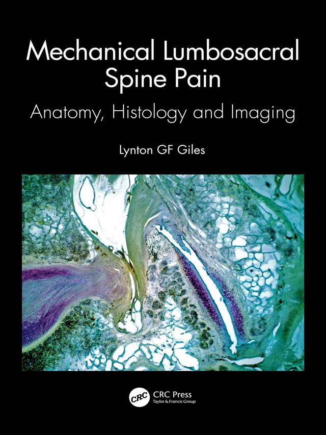 Mechanical Lumbosacral Spine Pain by Lynton GF Giles