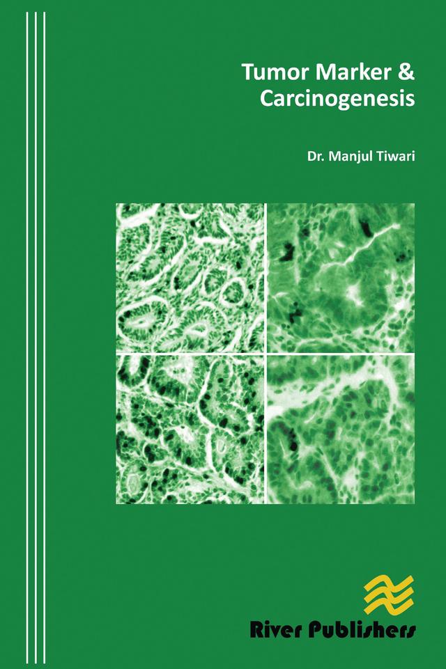 Tumor Marker and Carcinogenesis by Manjul Tiwari