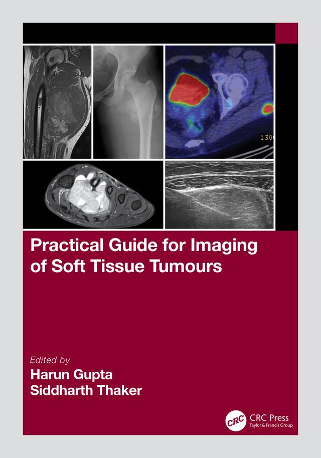 Practical Guide for Imaging of Soft Tissue Tumours by Harun Gupta, Siddharth Thaker