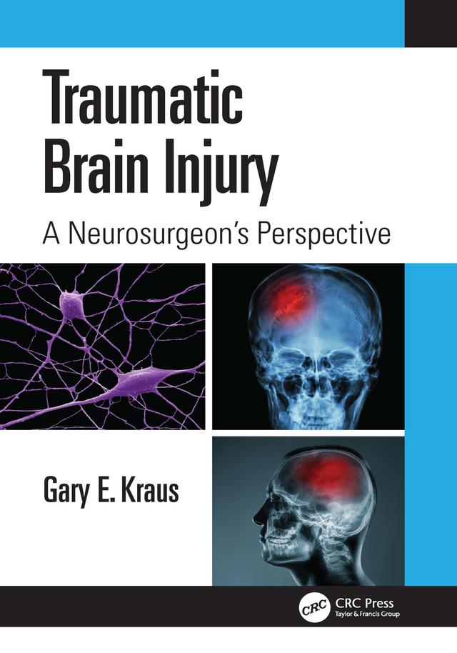 Traumatic Brain Injury: A Neurosurgeon's Perspective by Gary Kraus