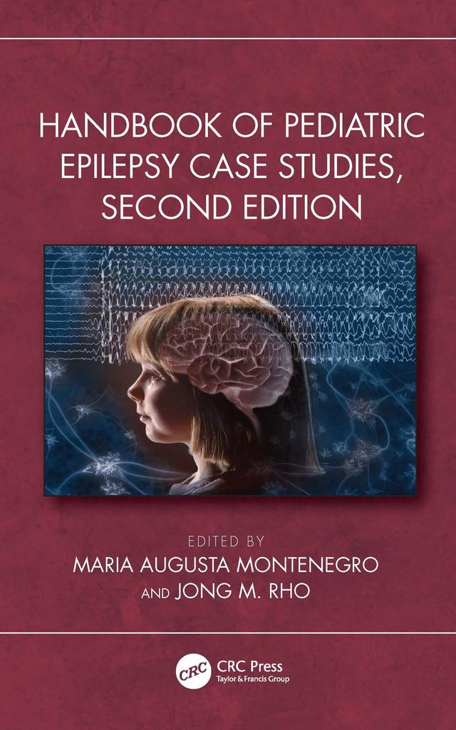 Handbook of Pediatric Epilepsy Case Studies, Second Edition by Jong M. Rho, Maria Augusta Montenegro