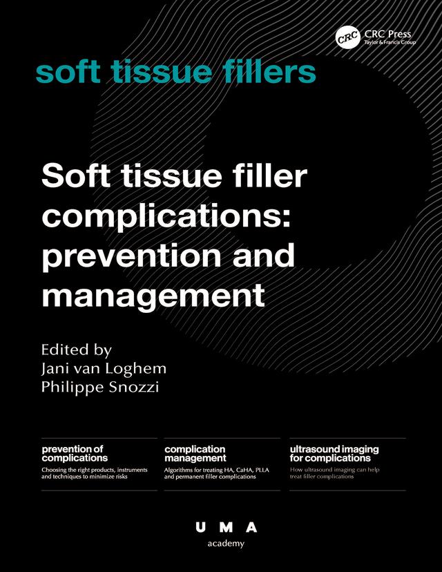 Soft Tissue Filler Complications by Jani van Loghem, Philippe Snozzi
