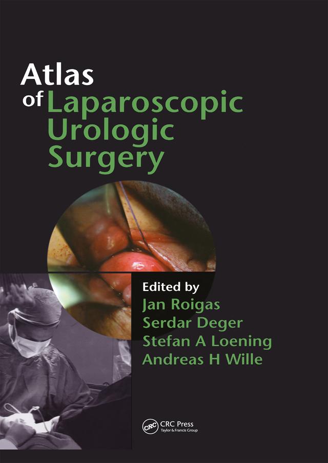 Atlas of Laparoscopic Urologic Surgery by Andreas Wille, Jan Roigas, Serdar Deger, Stefan Loening
