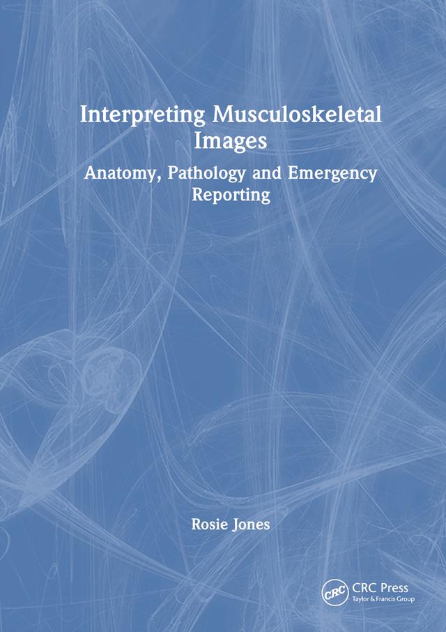 Interpreting Musculoskeletal Images by Rosie Jones