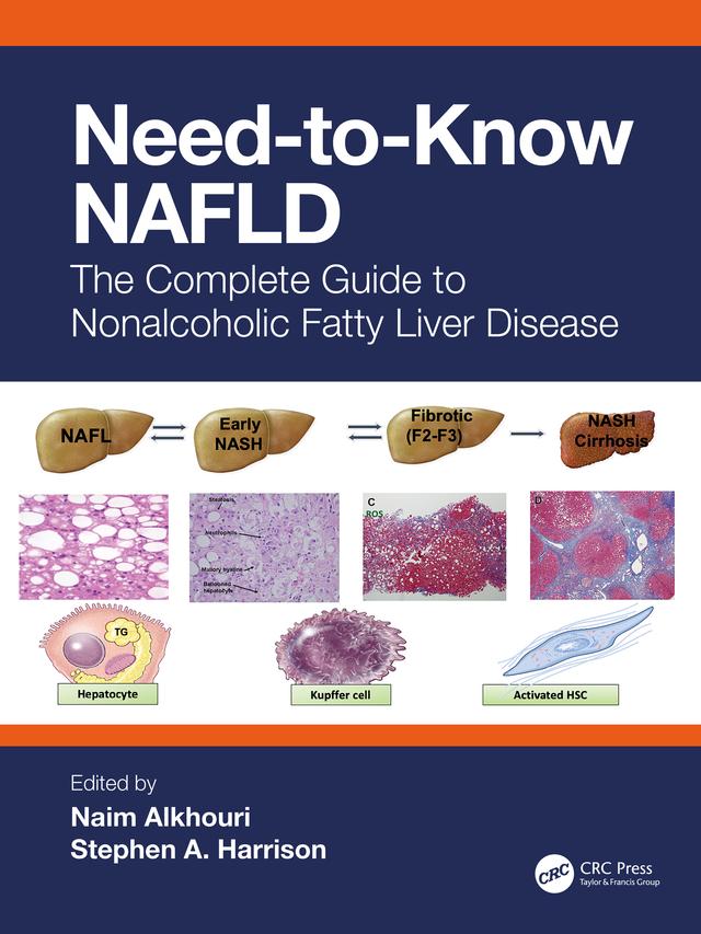 Need-to-Know NAFLD by Naim Alkhouri, Stephen A. Harrison