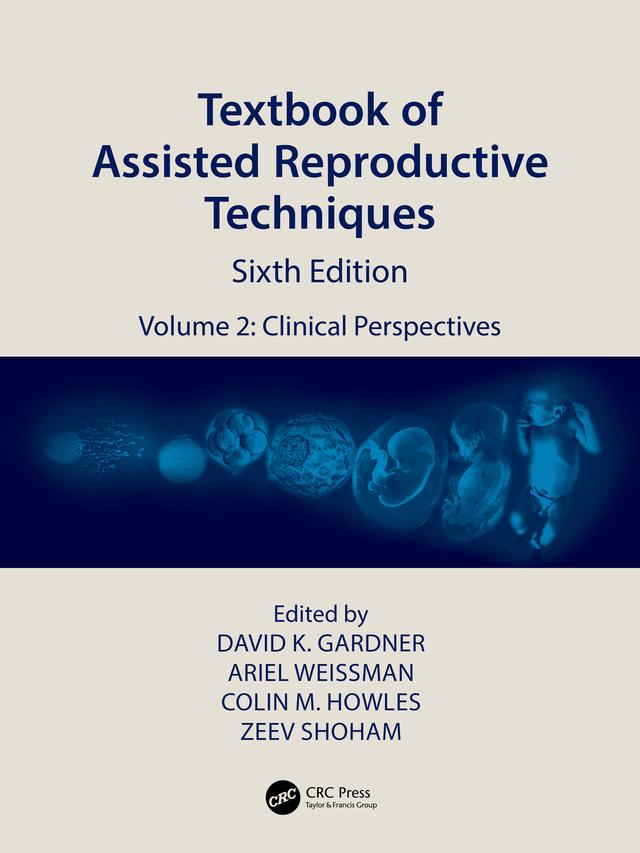 Textbook of Assisted Reproductive Techniques by Ariel Weissman, Colin M. Howles, David K. Gardner, Zeev Shoham