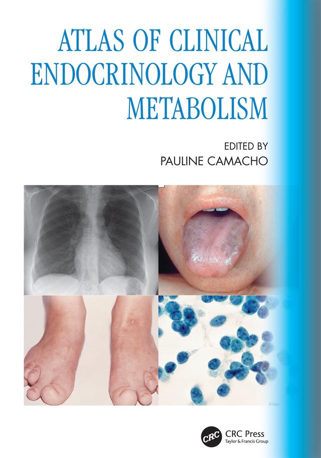 Atlas of Clinical Endocrinology and Metabolism by Pauline Camacho