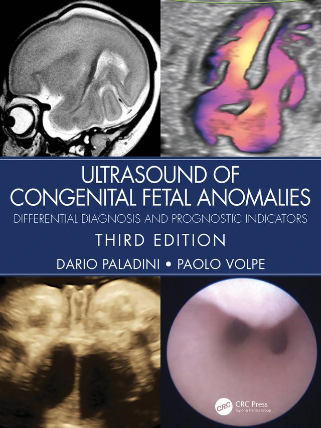 Ultrasound of Congenital Fetal Anomalies by Dario Paladini, Paolo Volpe