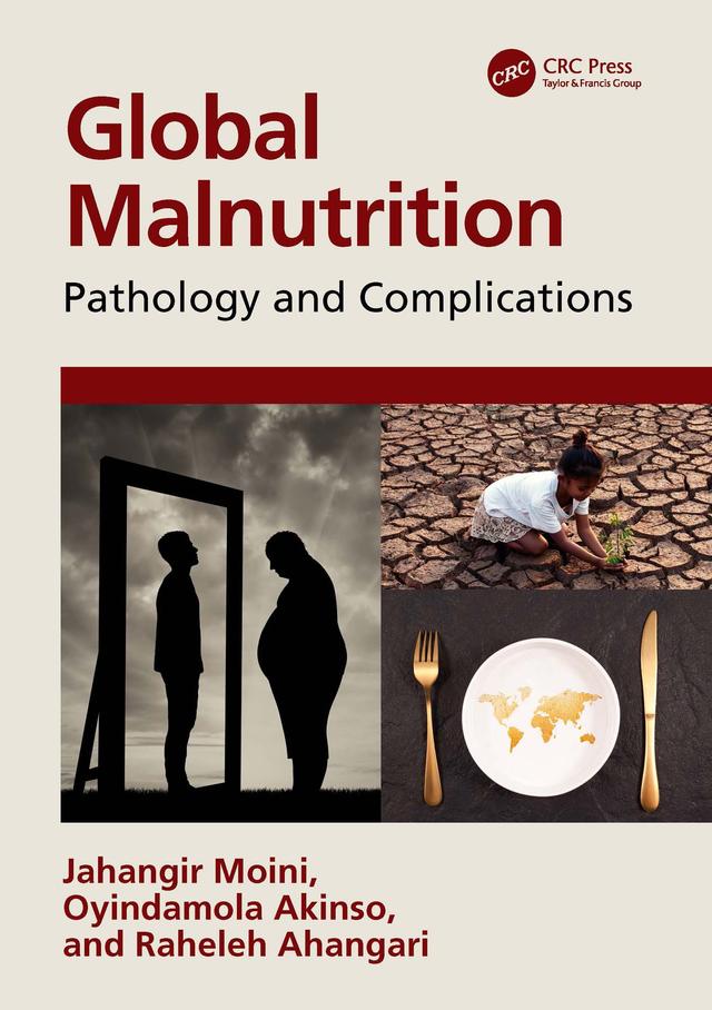 Global Malnutrition by Jahangir Moini, Oyindamola Akinso, Raheleh Ahangari