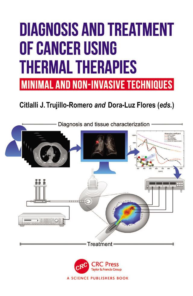 Diagnosis and Treatment of Cancer using Thermal Therapies by Citlalli J. Trujillo Romero, Dora-Luz Flores