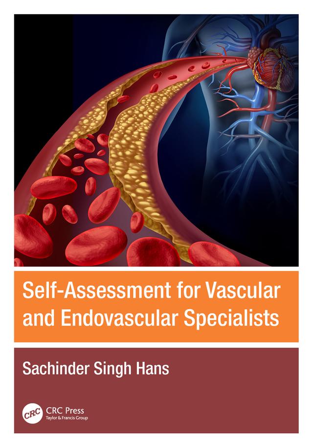 Self-Assessment for Vascular and Endovascular Specialists by Sachinder Singh Hans