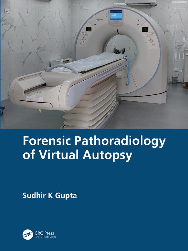 Forensic Pathoradiology of Virtual Autopsy by Sudhir K Gupta
