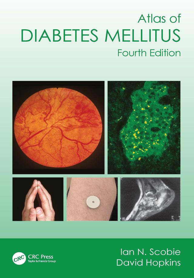 Atlas of Diabetes Mellitus by David Hopkins, Ian N. Scobie