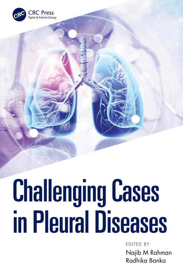 Challenging Cases in Pleural Diseases by Najib Rahman, Radhika Banka