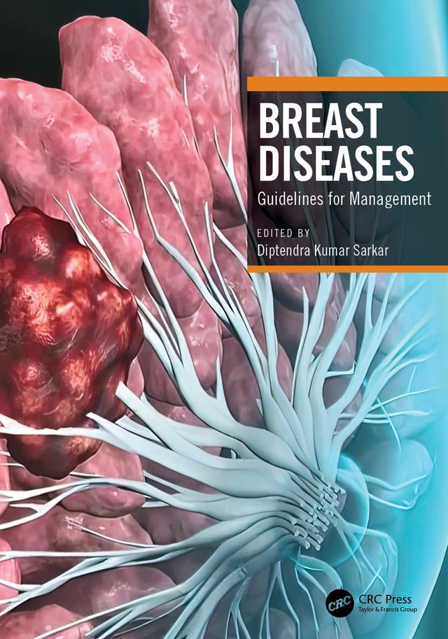 Breast Diseases by Diptendra Kumar Sarkar