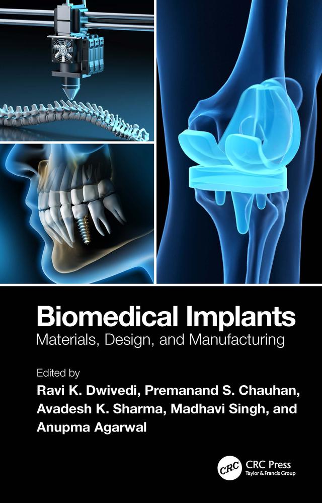 Biomedical Implants by Anupma Agarwal, Avadesh K. Sharma, Madhavi Singh, Premanand S. Chauhan, Ravi K. Dwivedi
