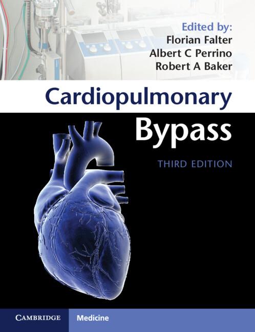 Cardiopulmonary Bypass by Albert C. Perrino, Jr, Florian Falter, Robert A. Baker