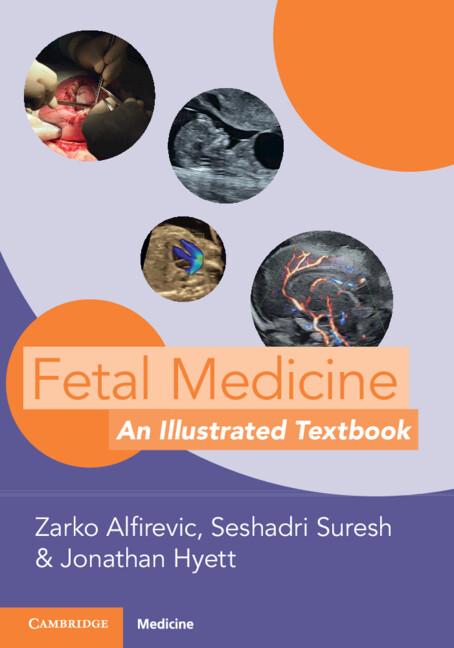 Fetal Medicine by Jonathan Hyett, Seshadri Suresh, Zarko Alfirevic
