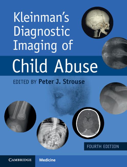 Kleinman's Diagnostic Imaging of Child Abuse by Peter J. Strouse
