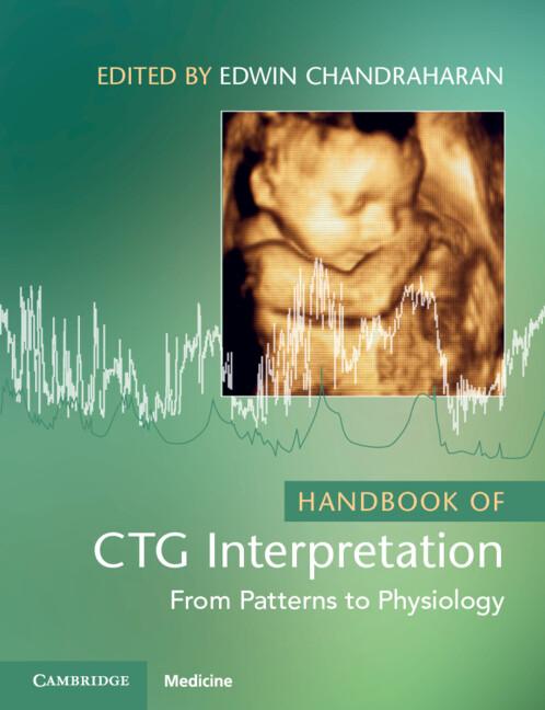 Handbook of CTG Interpretation by Edwin Chandraharan