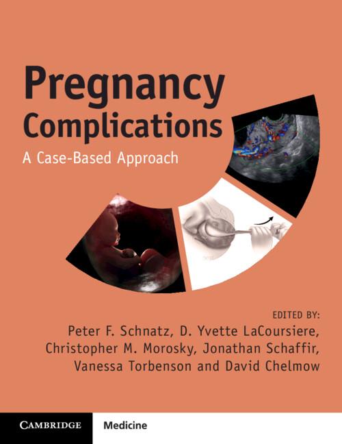 Pregnancy Complications by Christopher M. Morosky, David Chelmow, D. Yvette LaCoursiere, Jonathan Schaffir, Peter F. Schnatz, Vanessa Torbenson