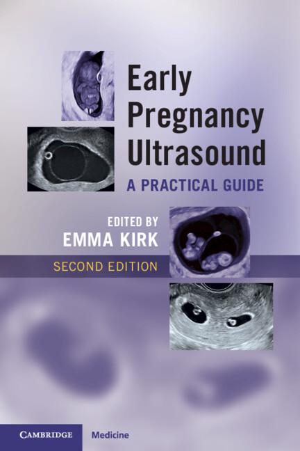 Early Pregnancy Ultrasound by Emma Kirk