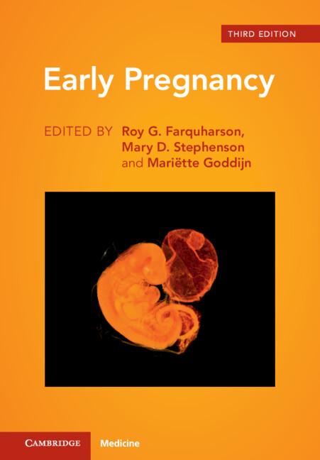 Early Pregnancy by Mariëtte Goddijn, Mary D. Stephenson, Roy G. Farquharson