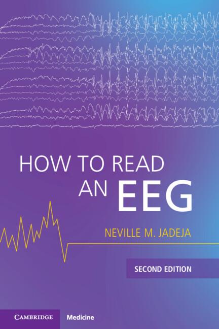 How to Read an EEG by Neville M. Jadeja