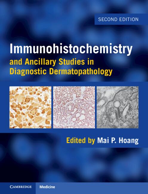 Immunohistochemistry and Ancillary Studies in Diagnostic Dermatopathology by Mai P. Hoang