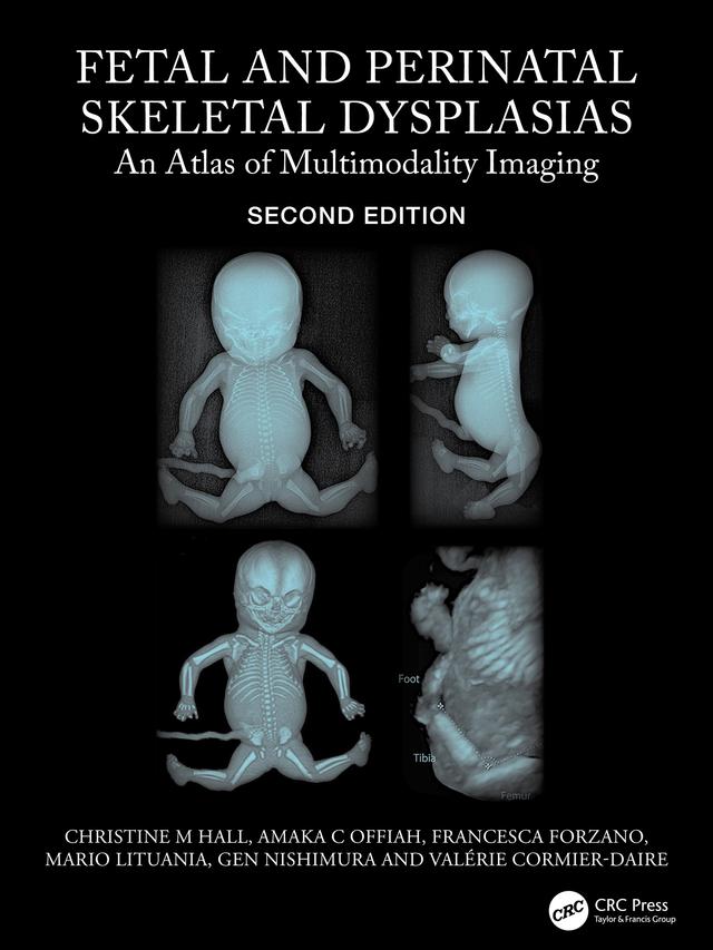 Fetal and Perinatal Skeletal Dysplasias by Amaka C Offiah, Christine M Hall, Francesca Forzano, Gen Nishimura, Mario Lituania, Valerie Cormier-Daire