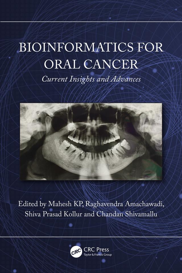 Bioinformatics for Oral Cancer by Chandan Shivamallu, Mahesh KP, Raghavendra Amachawadi, Shiva Prasad Kollur