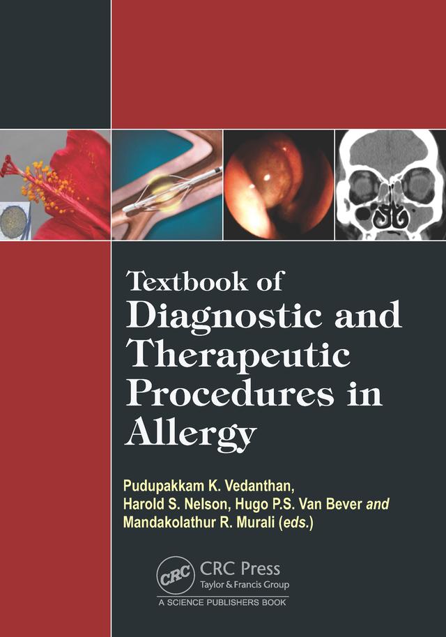 Textbook of Diagnostic and Therapeutic Procedures in Allergy by Harold S. Nelson, Hugo Van Bever, Mandakolathur R Murali, Pudupakkam K. Vedanthan