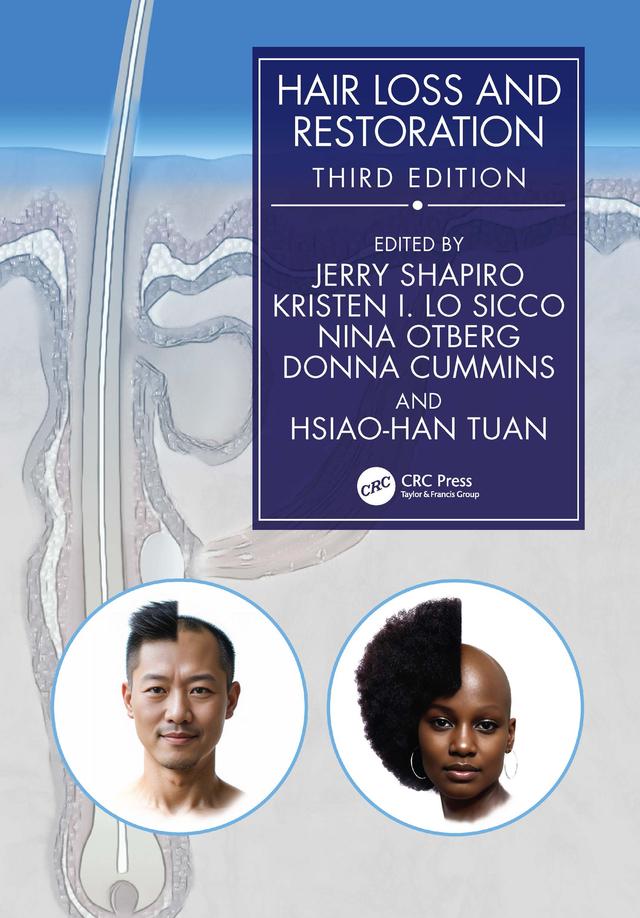 Hair Loss and Restoration by Donna Cummins, Hsiao-Han Tuan, Jerry Shapiro, Kristen Lo Sicco, Nina Otberg
