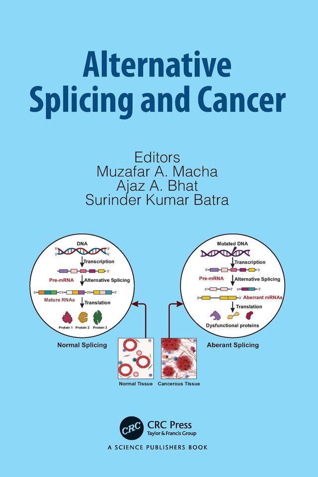Alternative Splicing and Cancer by Ajaz A. Bhat, Muzafar A. Macha, Surinder Kumar Batra