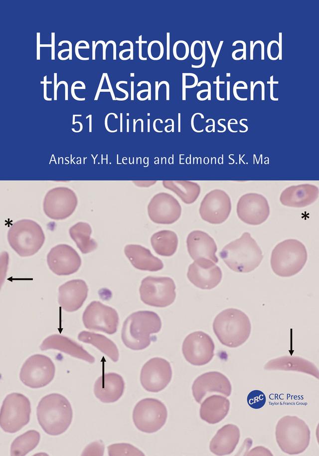 Haematology and the Asian Patient by Anskar Y.H. Leung, Edmond S K Ma