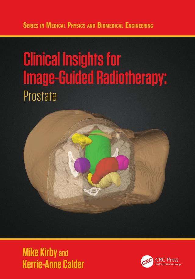 Clinical Insights for Image-Guided Radiotherapy by Kerrie-Anne Calder, Mike Kirby