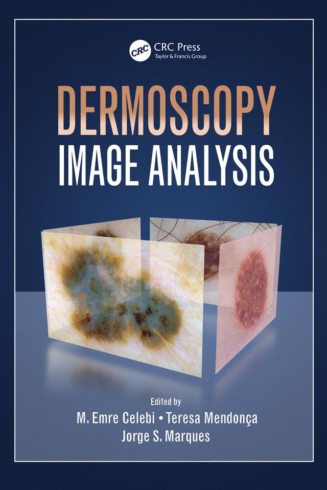 Dermoscopy Image Analysis by Jorge S. Marques, M. Emre Celebi, Teresa Mendonca