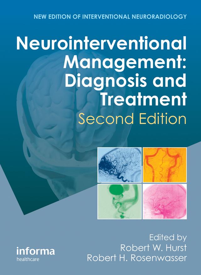 Neurointerventional Management by Robert H. Rosenwasser, Robert W. Hurst