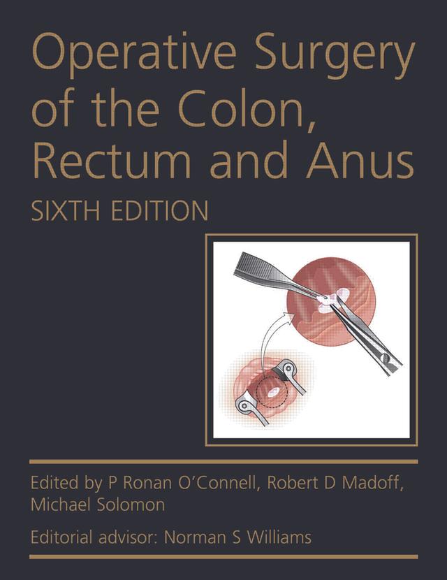 Operative Surgery of the Colon, Rectum and Anus by Michael Solomon, P Ronan O'Connell, Robert D. Madoff