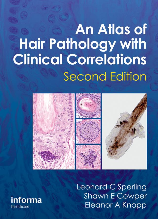 An Atlas of Hair Pathology with Clinical Correlations by Eleanor A. Knopp, Leonard C Sperling, Shawn E. Cowper