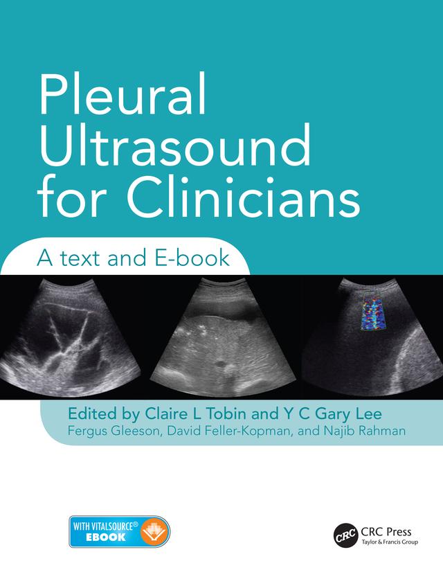 Pleural Ultrasound for Clinicians by Claire Tobin, David Feller-Kopman, Fergus Gleeson, Najib Rahman, Y C Gary Lee