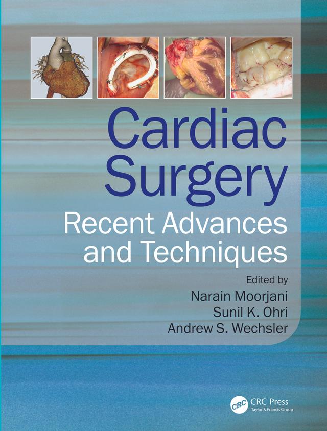 Cardiac Surgery by Andrew Wechsler, Narain Moorjani, Sunil K Ohri