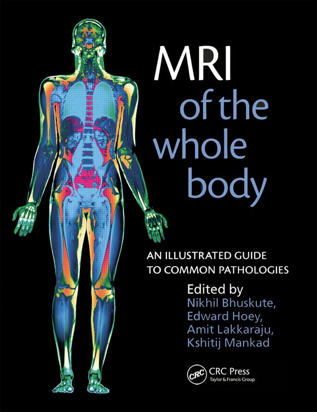 MRI of the Whole Body by Amit Lakkaraju, Edward Hoey, Kshitij Mankad, Nikhil Bhuskute