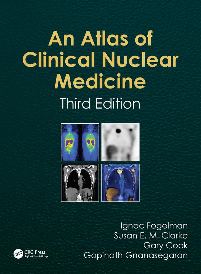 Atlas of Clinical Nuclear Medicine by Gary Cook, Gopinath Gnanasegaran, Ignac Fogelman, Susan Clarke
