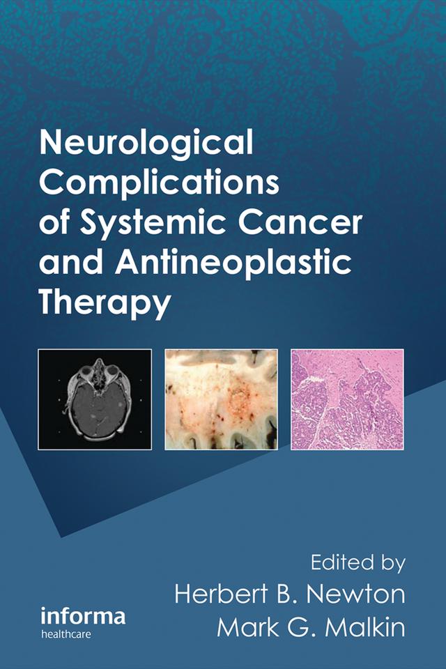 Neurological Complications of Systemic Cancer and Antineoplastic Therapy by Herbert B. Newton, Mark G. Malkin