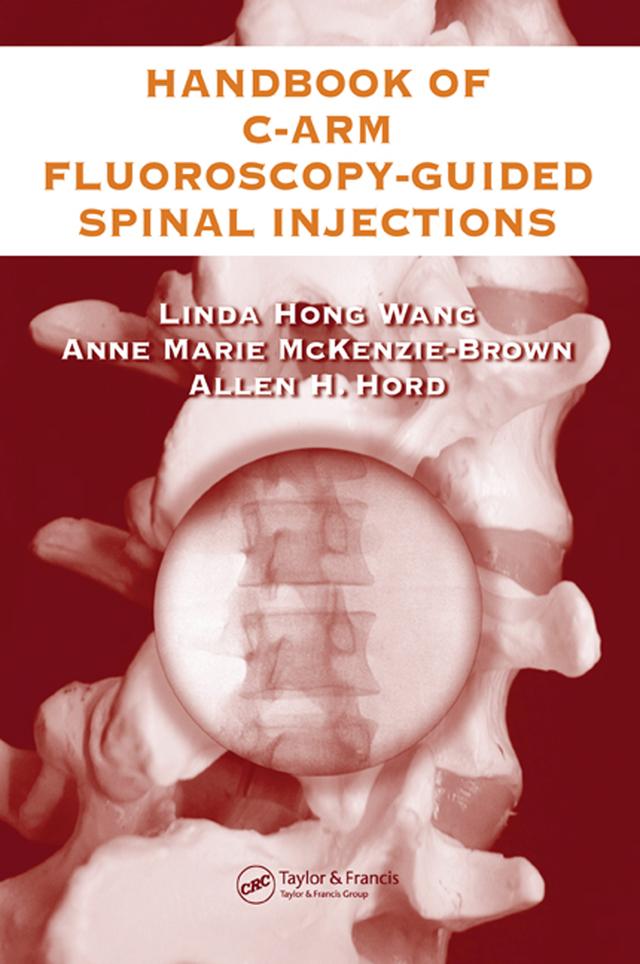The Handbook of C-Arm Fluoroscopy-Guided Spinal Injections by Allen Hord, Anne Marie McKenzie-Brown, Linda Hong Wang