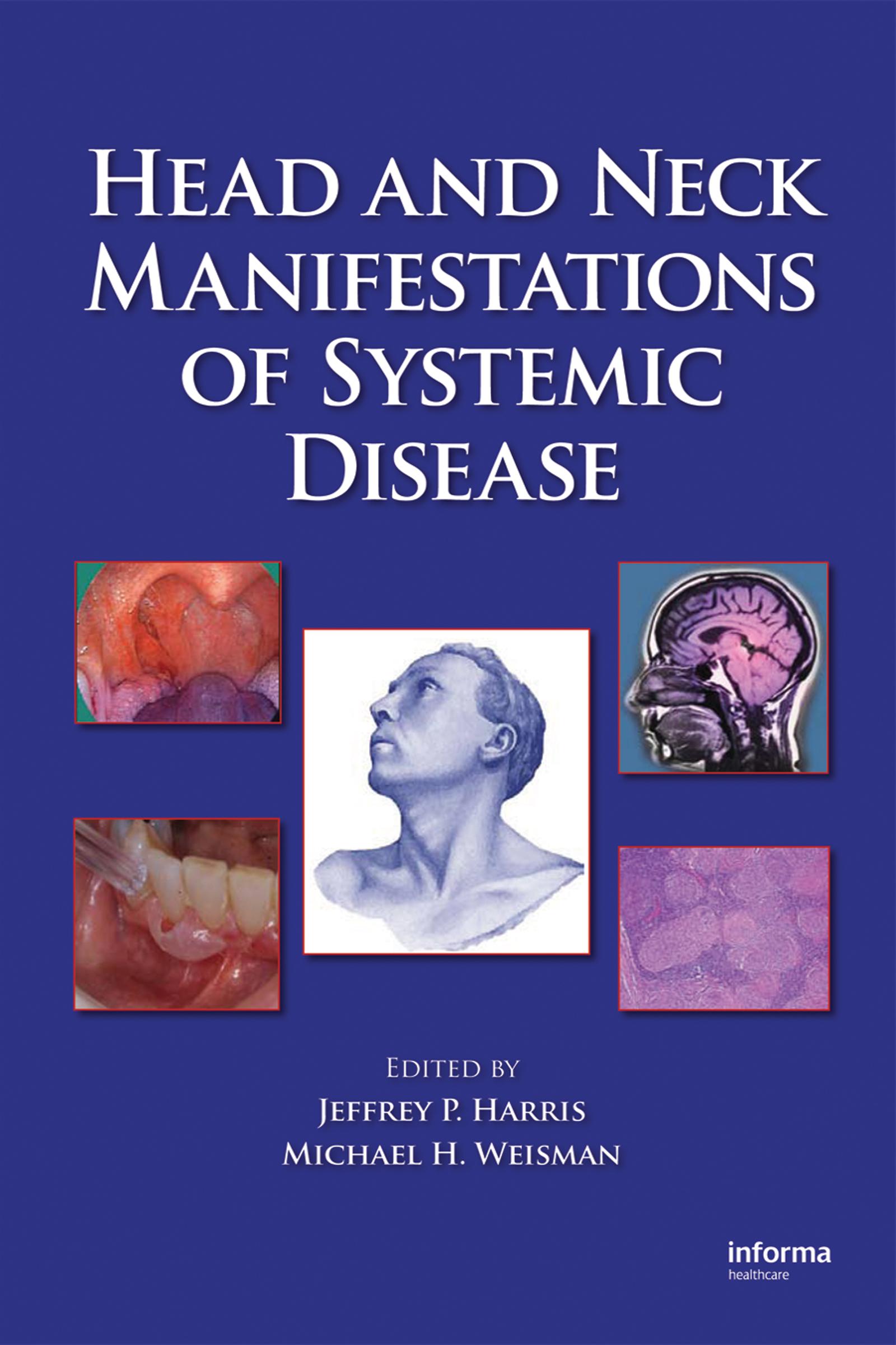 Head and Neck Manifestations of Systemic Disease