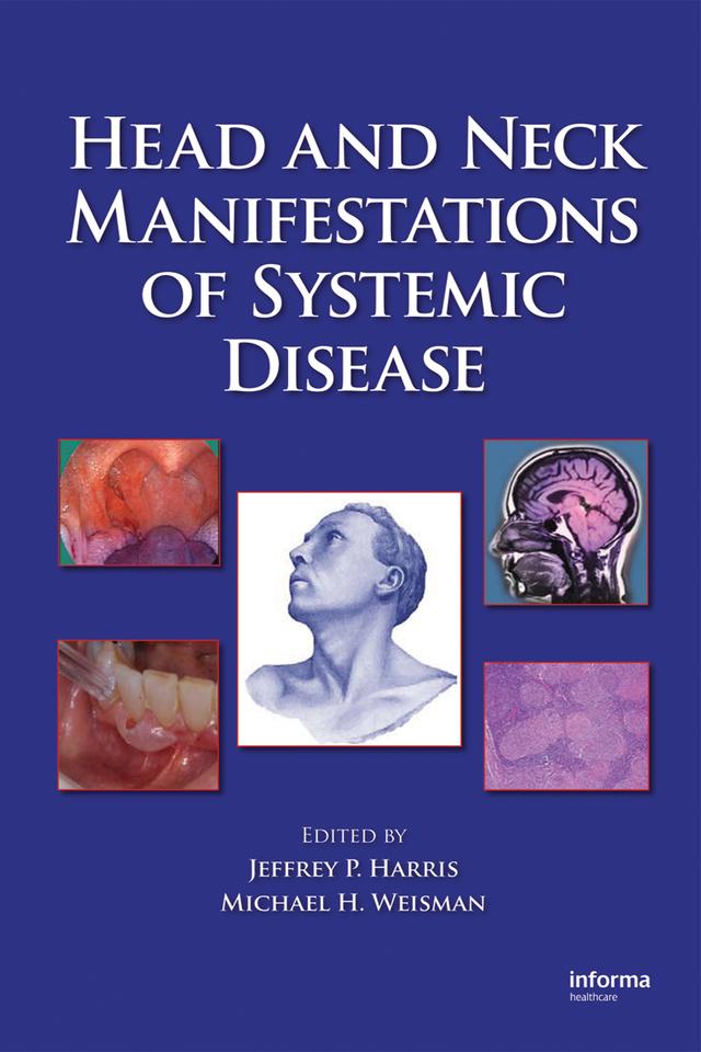 Head and Neck Manifestations of Systemic Disease by Jeffrey P. Harris, Michael H. Weisman