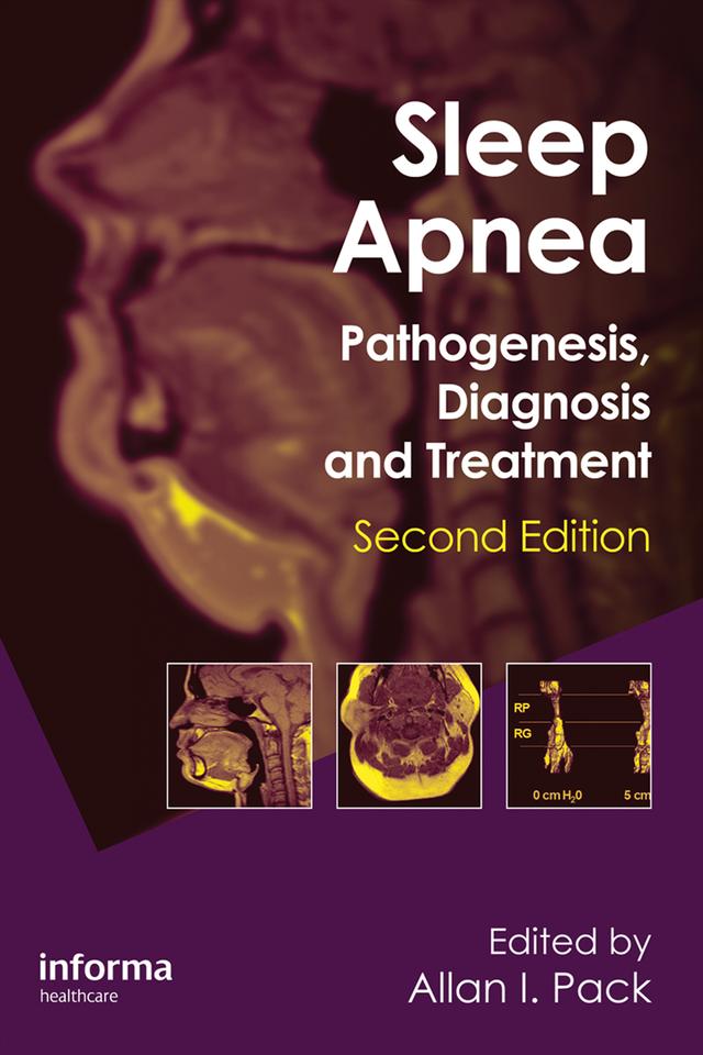 Sleep Apnea by Allan I. Pack
